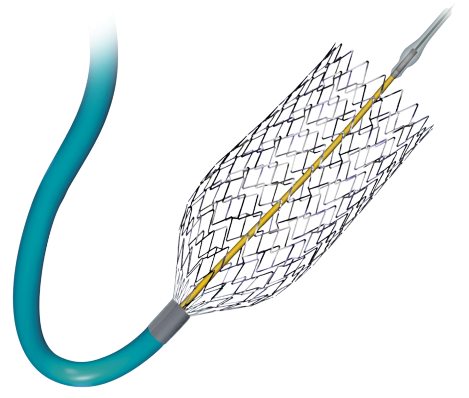 Coronary Stent